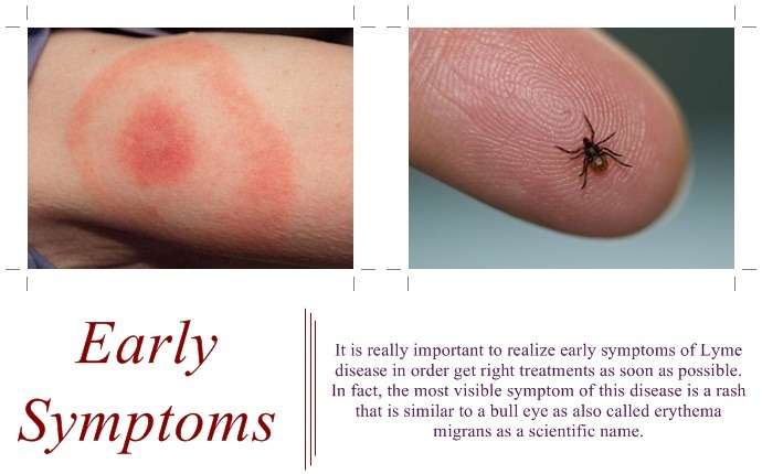 4 Common Signs And Symptoms Of Lyme Disease In Adults