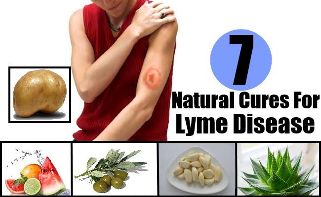 7 Natural Cures For Lyme Disease  Natural Home Remedies ...
