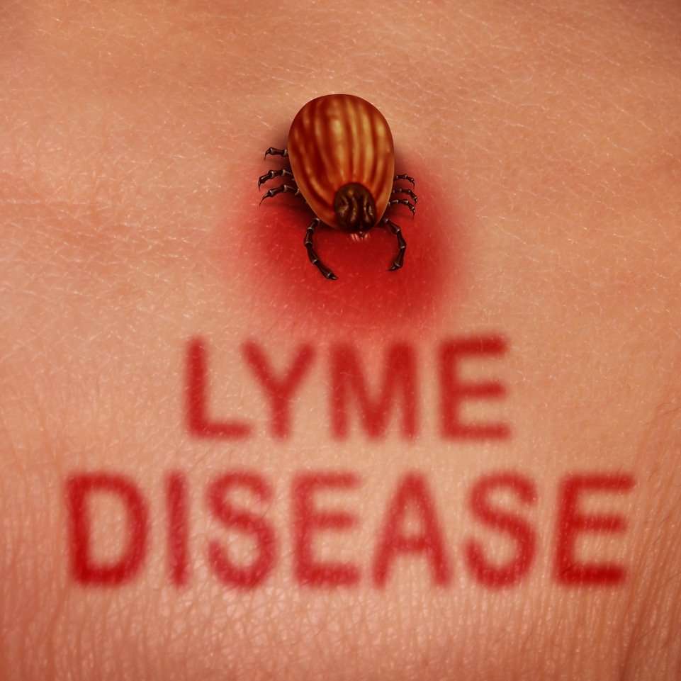 7 Weird Symptoms of Lyme Disease that You Need to Know ...