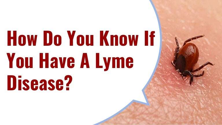 How Do You Know If You Have A Lyme Disease?