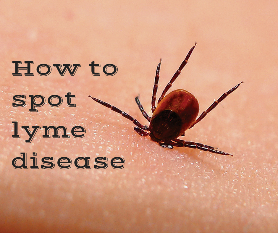 How to Spot Lyme Disease