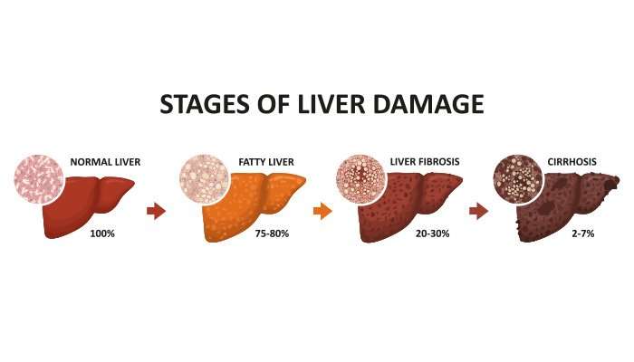 Keep Your Liver in Perfect Shape