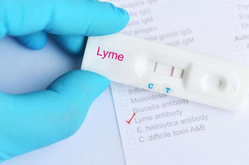 Lyme positive test result stock image. Image of biology ...