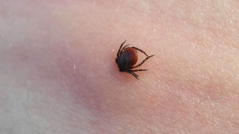 POW: A Tick Disease Worse Than Lyme?