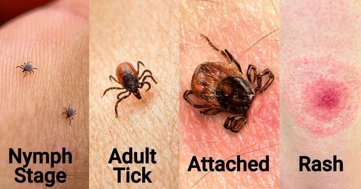 BE TICKED OFF! â Lyme Disease Is Preventable â KUUS Inc.