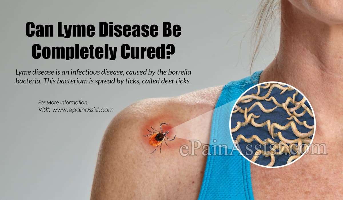 Can Lyme Disease Be Completely Cured?