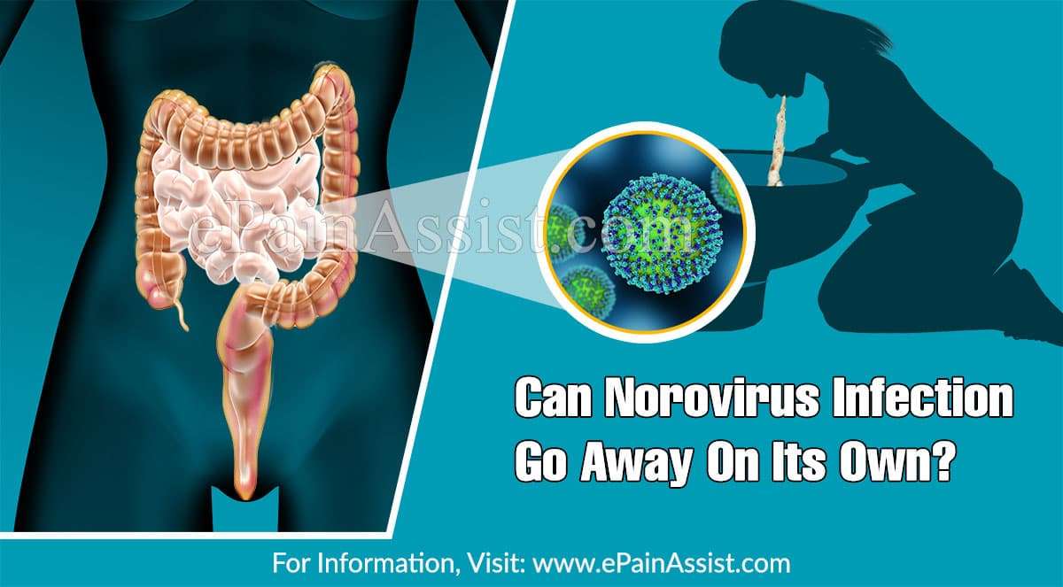 Can Norovirus Infection Go Away On Its Own &  What Are It