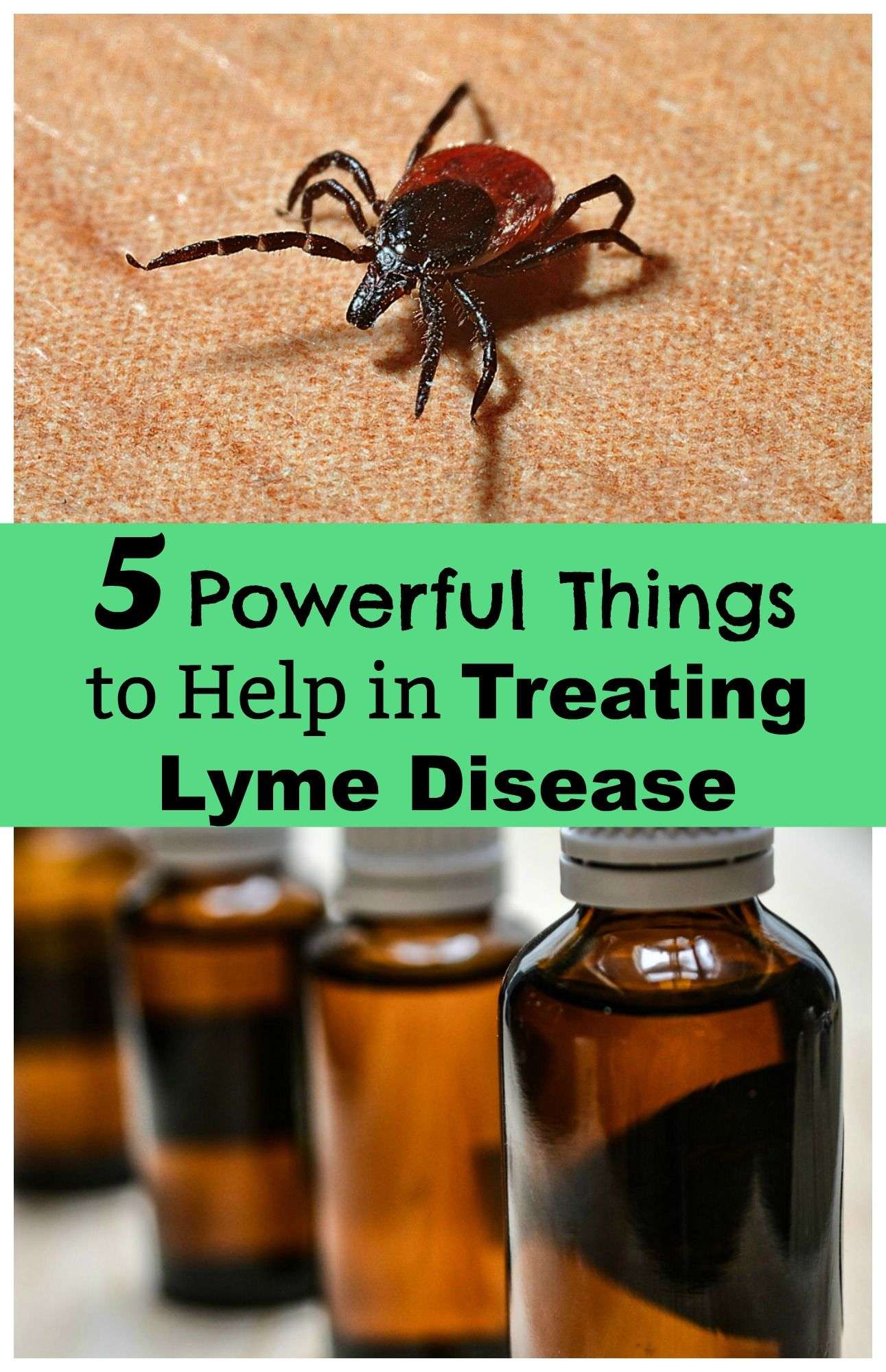 Five Powerful Things to Help in Treating Lyme Disease