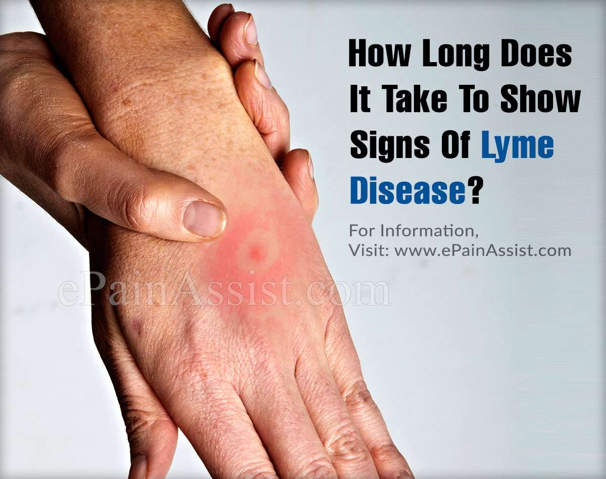 How Long Does It Take To Show Signs Of Lyme Disease?