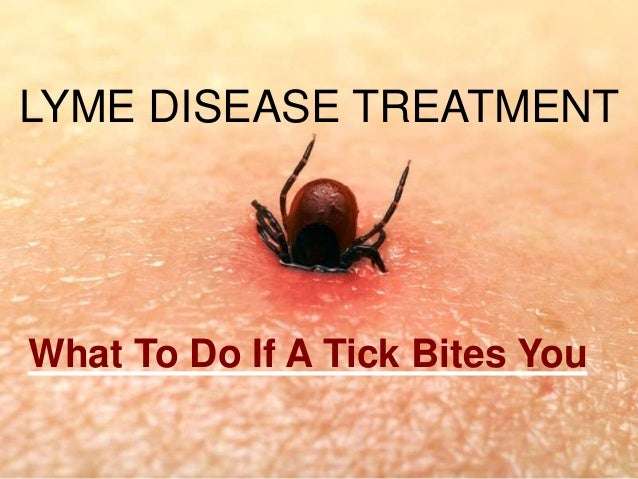 Lyme Disease Auf Deutsch