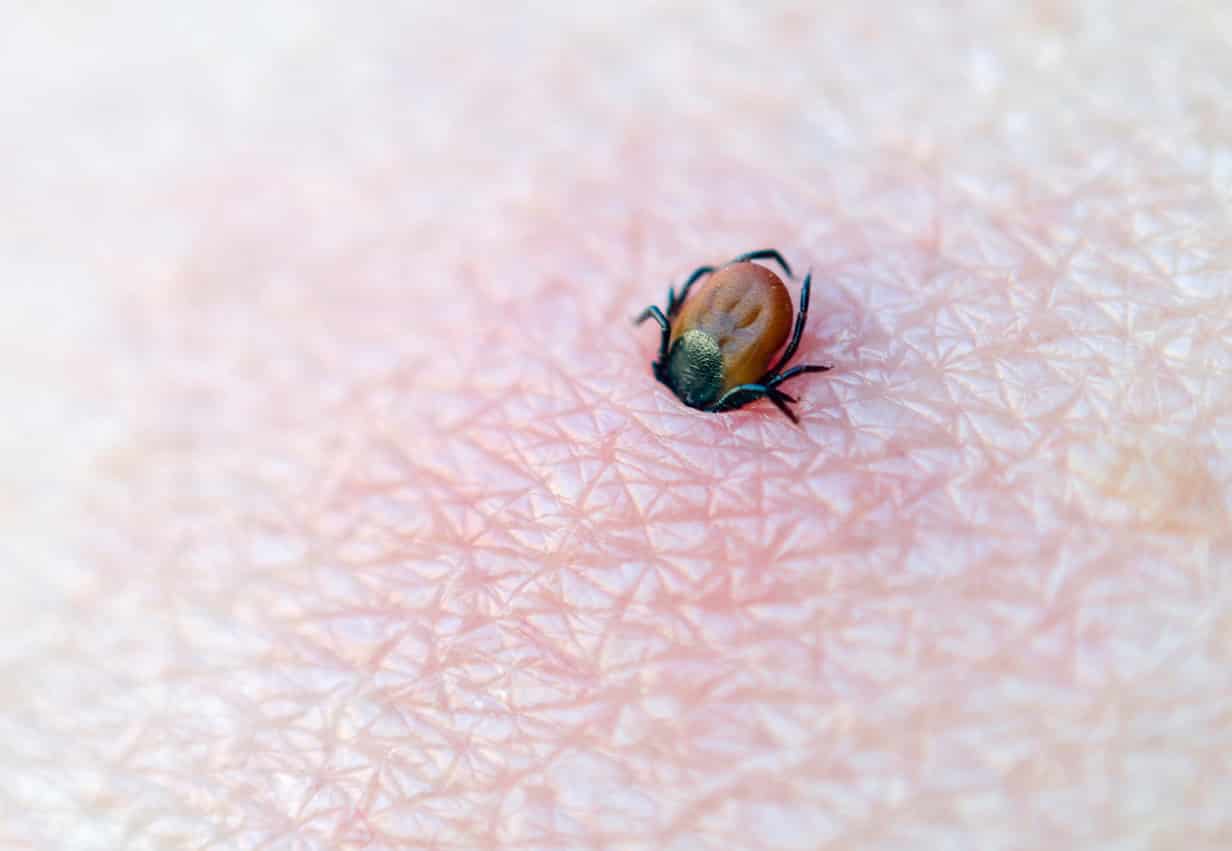 Lyme Disease In Italy