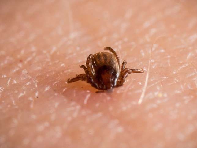 Lyme disease: What does a tick bite look like?