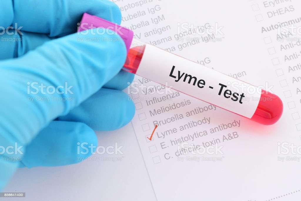 Lymeborreliose Test Stockfoto und mehr Bilder von ...