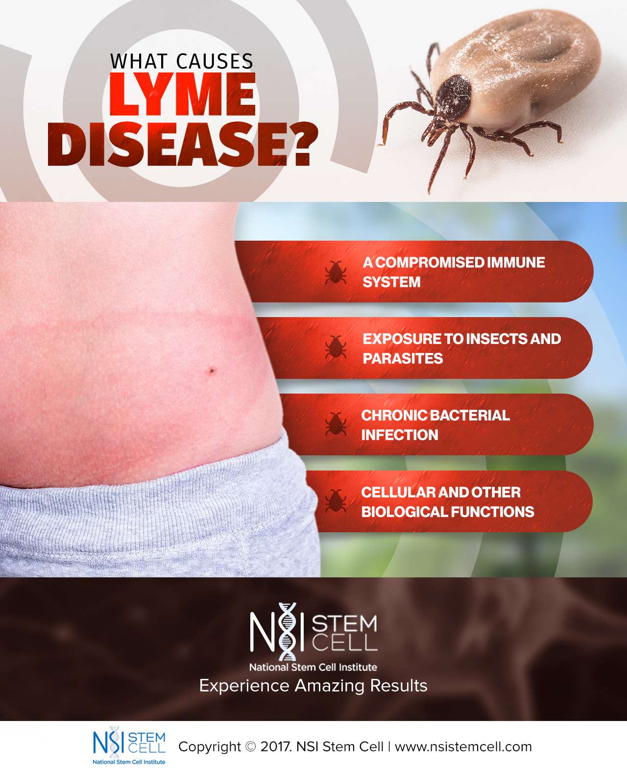 Natural Treatment For Lyme Disease