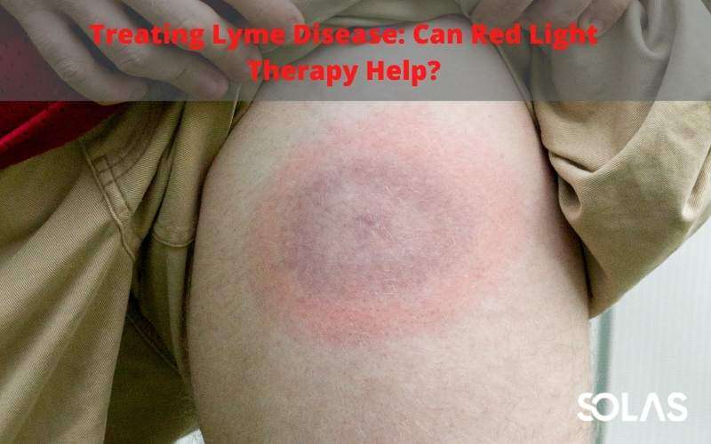 Treating Lyme Disease: Can Red Light Therapy Help?