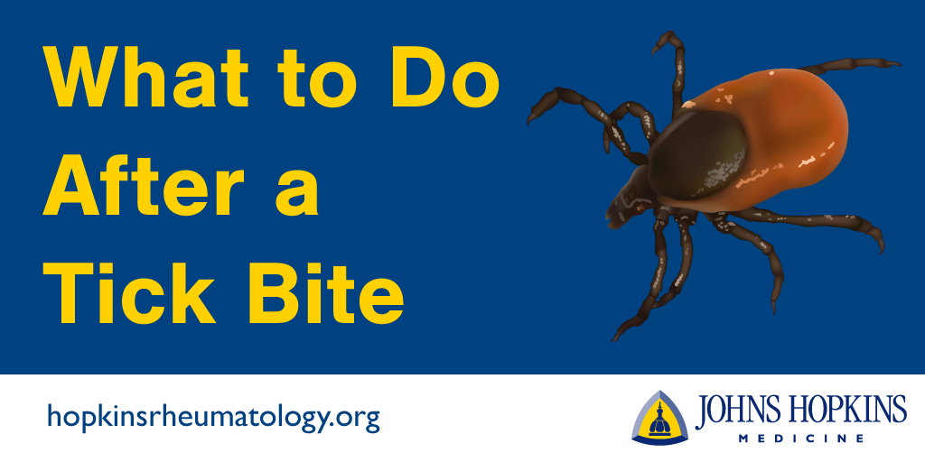 What to do after a tick bite