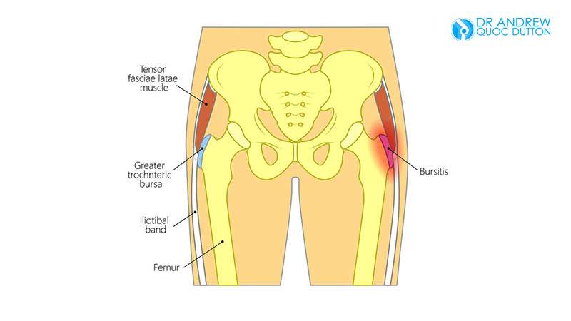 Where Is This Pain Coming From? [Troubleshooting Hip Bone ...