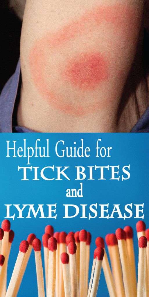 17 Best images about Anti ticks and Mosquitos on Pinterest ...