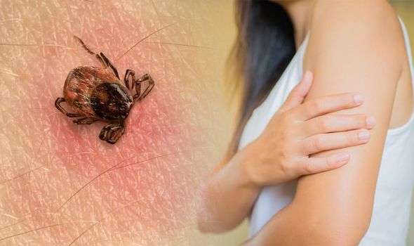 Lyme disease symptoms: Check your hair, groin and armpits ...