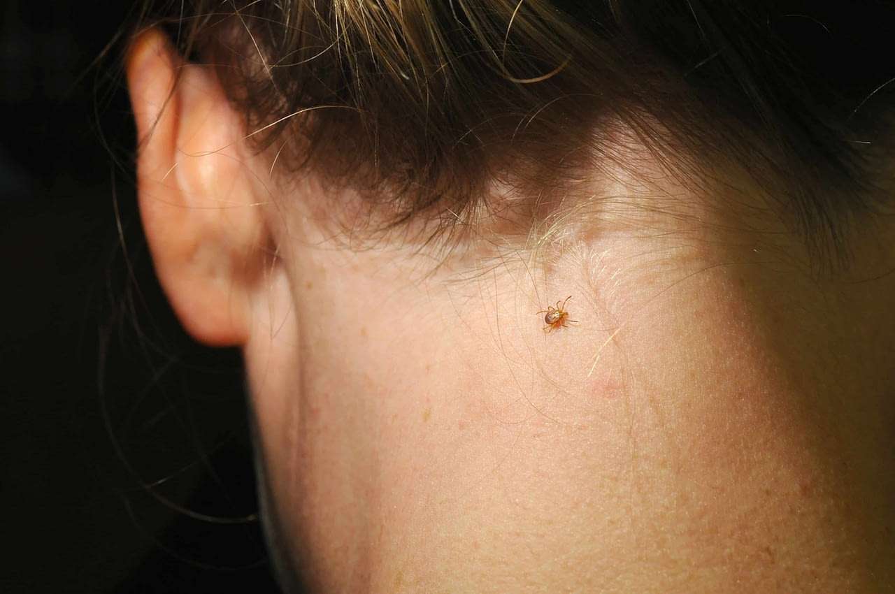Lyme Disease Symptoms Treatment