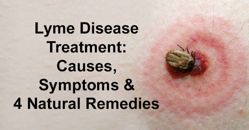 Lyme Disease Treatment: Causes, Symptoms &  4 Natural ...