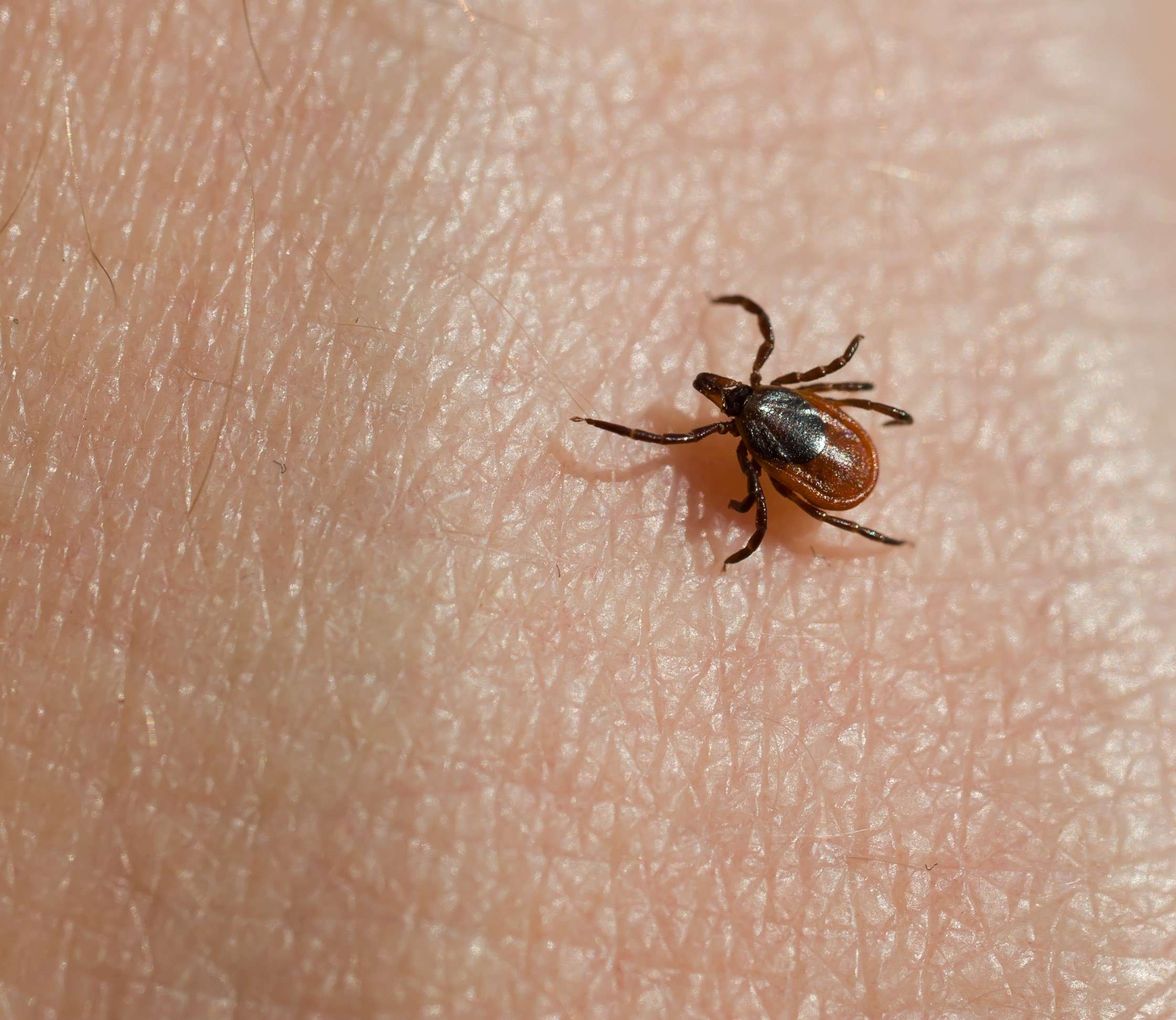 Ticks &  Lyme Disease â Western UP Health Department