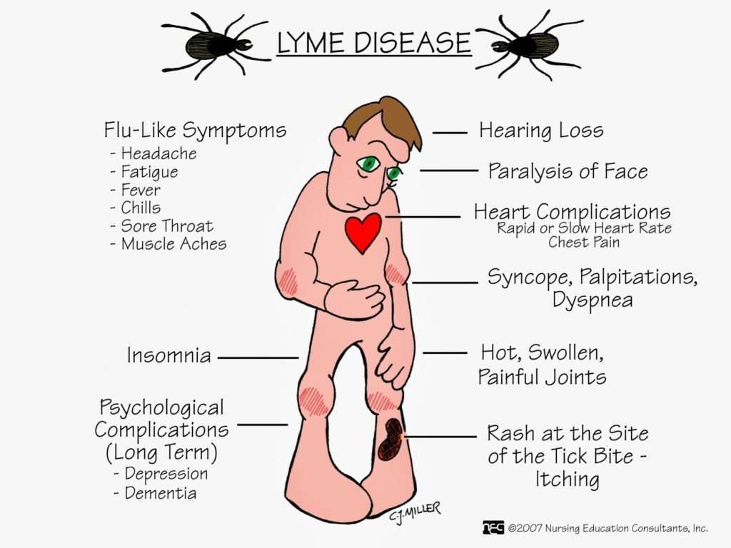 Where Do I Go To Get Tested For Lyme Disease