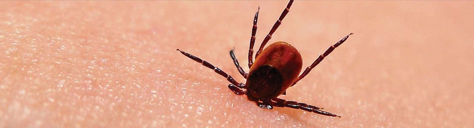 Bugs that Cause Lyme Disease