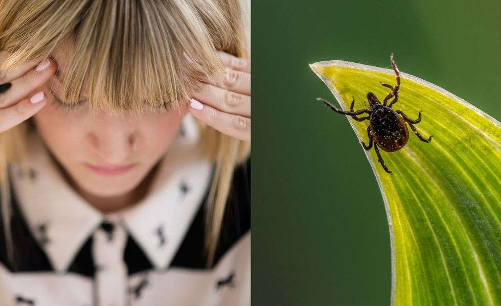 Doctors Reveal the Common Lyme Disease Symptoms You ...