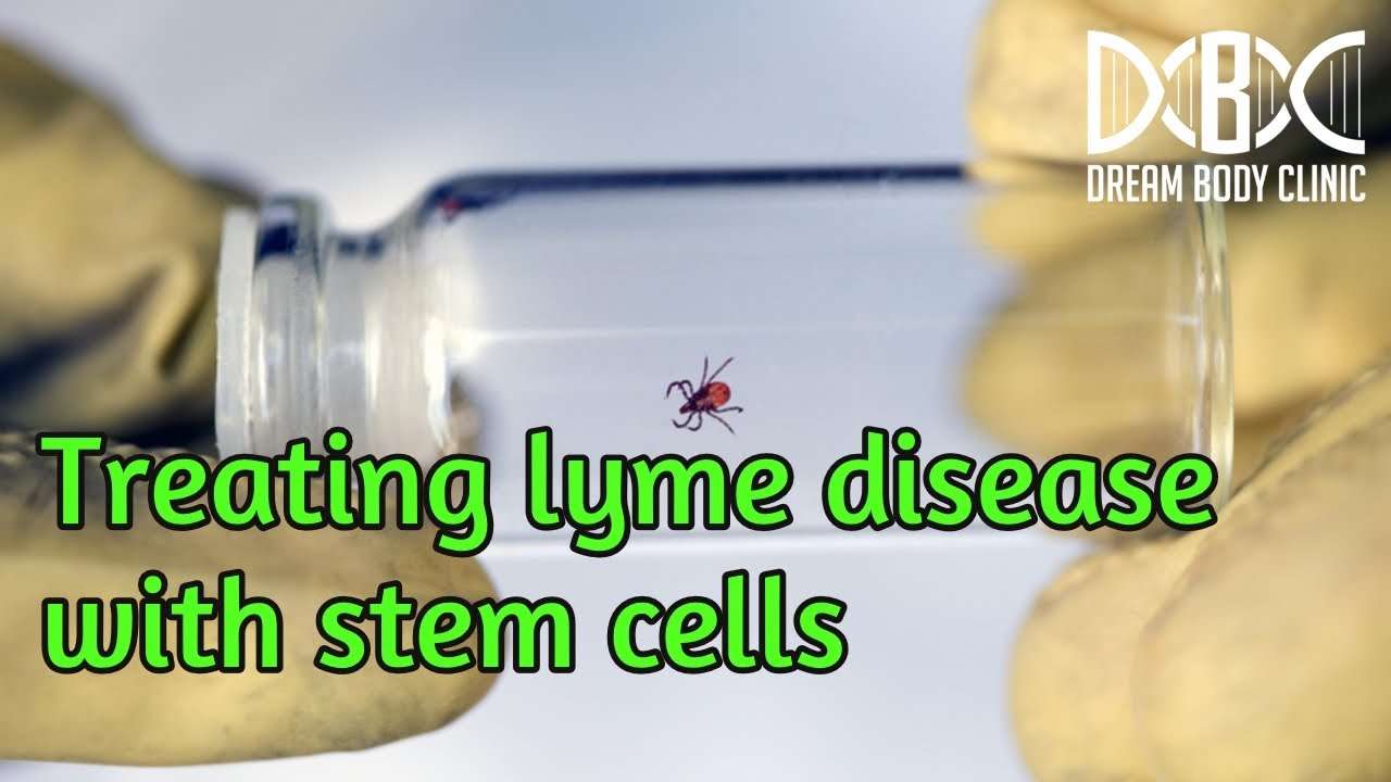 How stem cells can help with getting rid of Lyme disease ...
