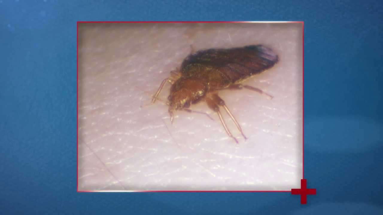 Lyme Disease Bed Bugs