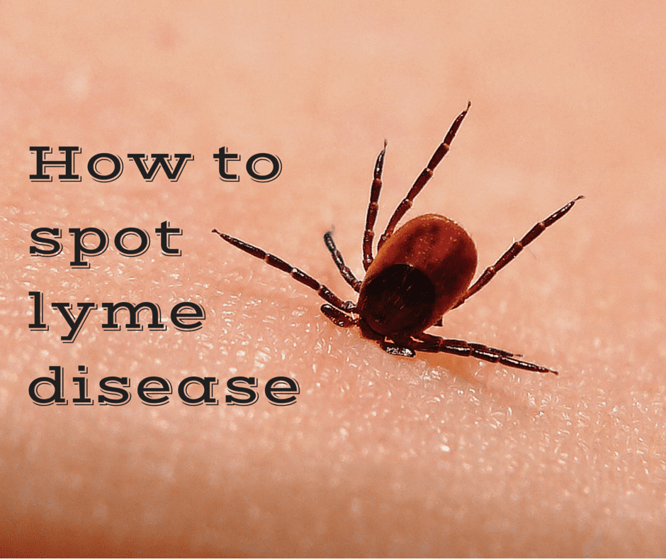 Lyme Disease Early Detection Test Work Well