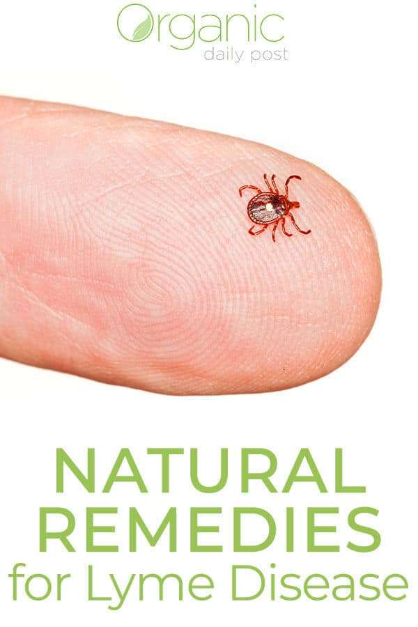 Natural Treatments for Lyme Disease (2018 Update)