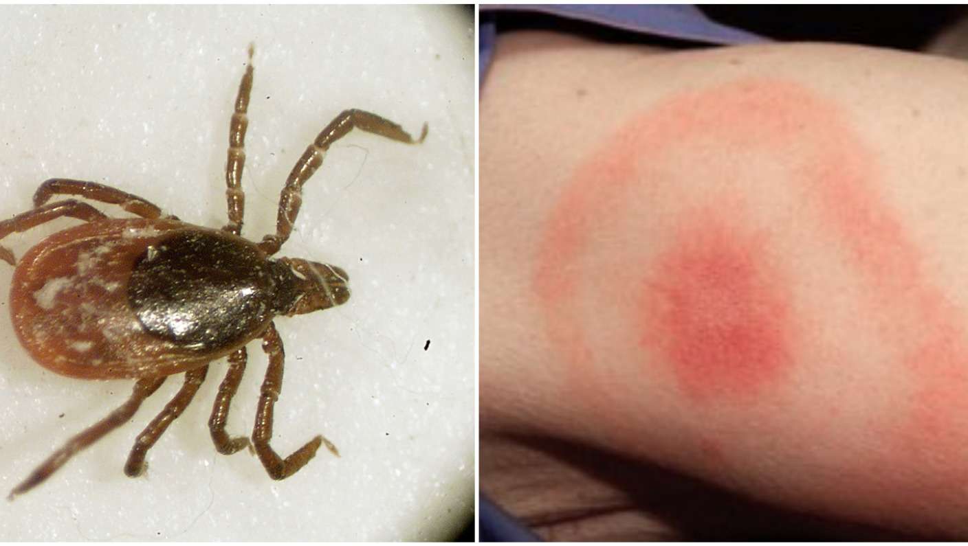 What is Lyme disease and what are the symptoms of the ...