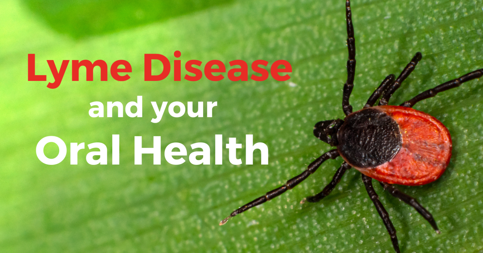 The Connection Between Lyme Disease and Oral Health