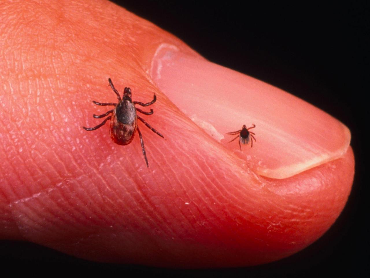 A new Lyme disease vaccine will soon be tested on Americans and Europeans