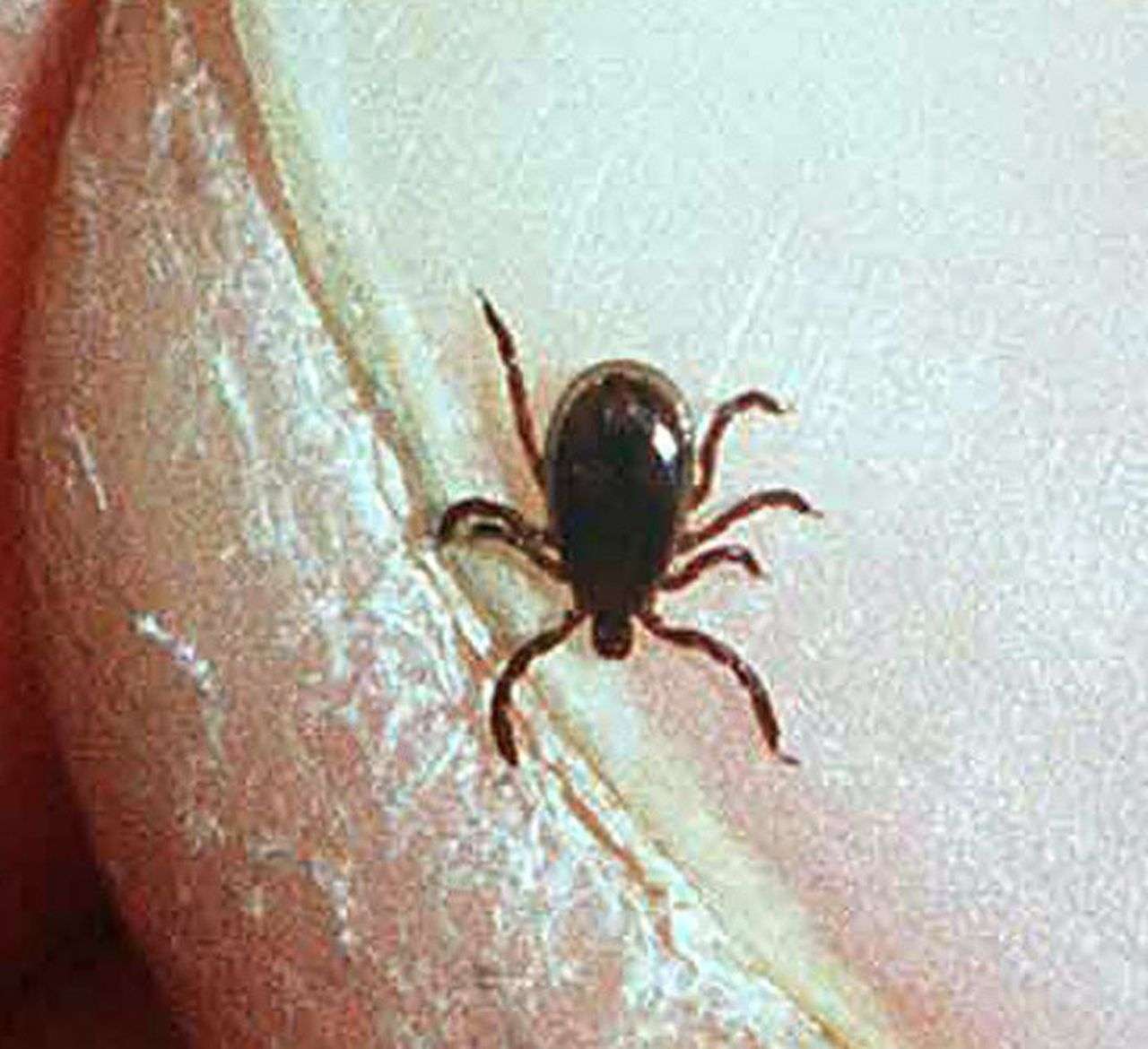 How many cases of Lyme disease where you live? Search our NY database ...