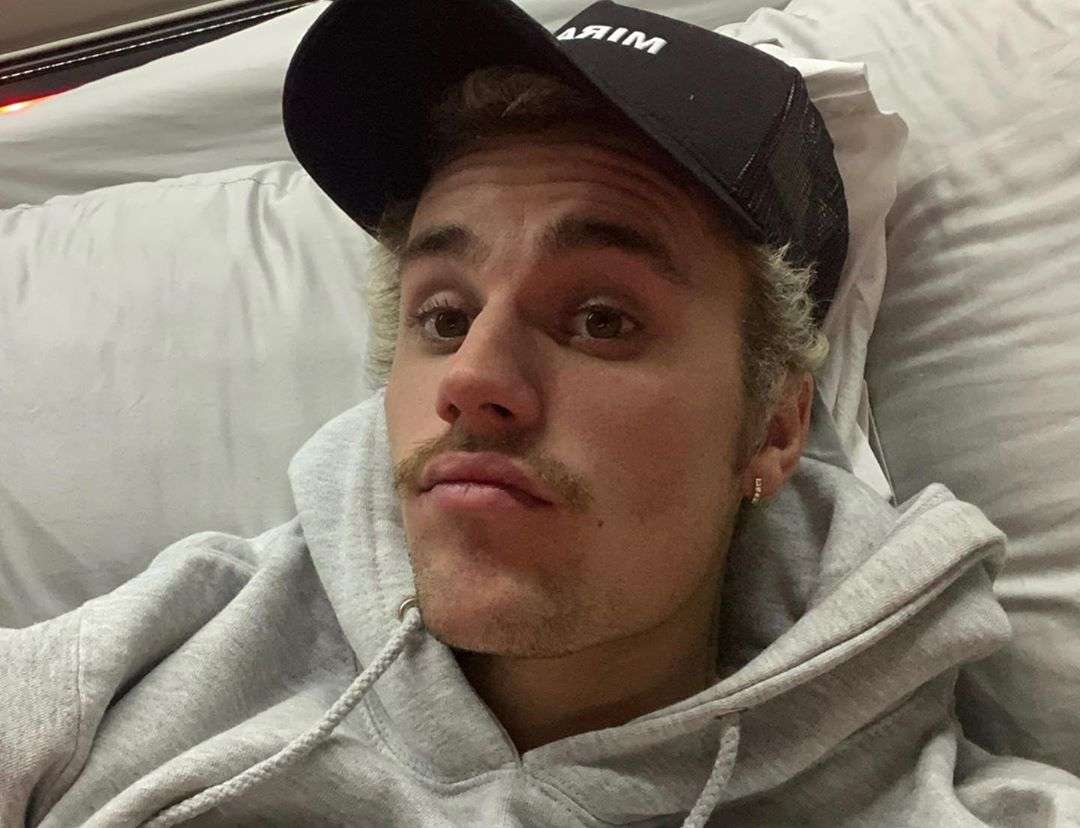 Justin Bieber Diagnosed With Lyme Disease