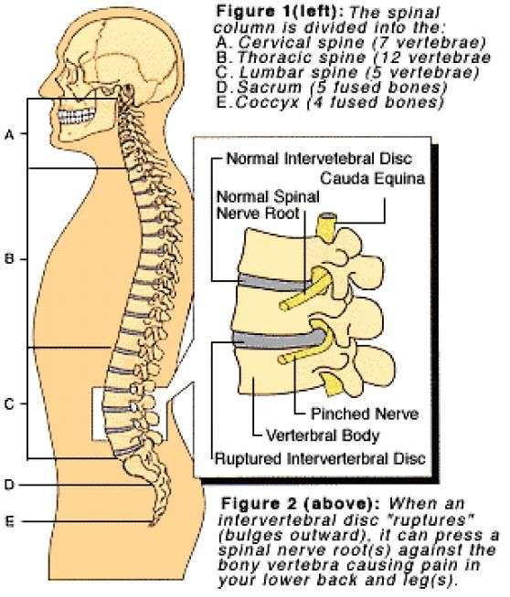 Pin em Back pain