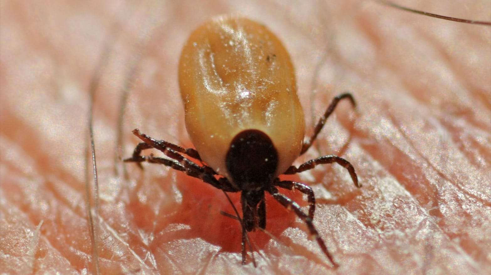 Why Lyme Disease Cases Are Spiking