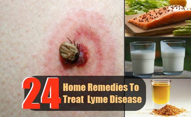 24 Effective Home Remedies To Treat Lyme Disease