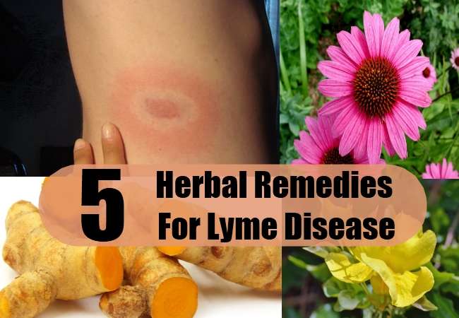 5 Lyme Disease Herbal Remedies, Treatments And Cures