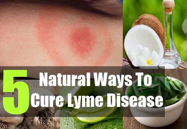 5 Natural Cure For Lyme Diseasee