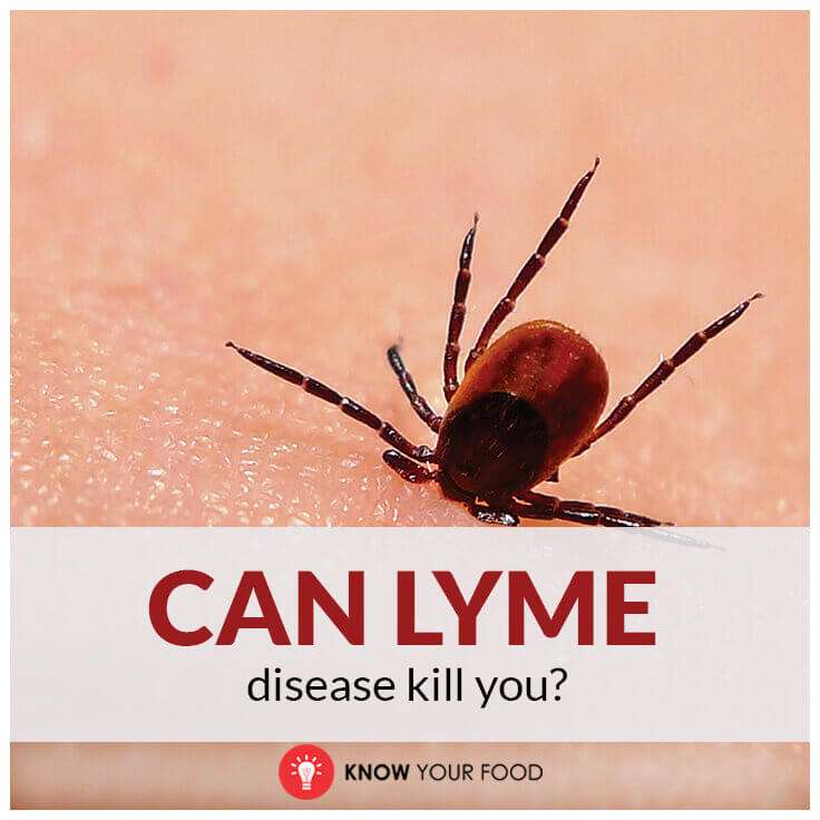 6 Natural Remedies and Dietary Changes for Lyme Disease