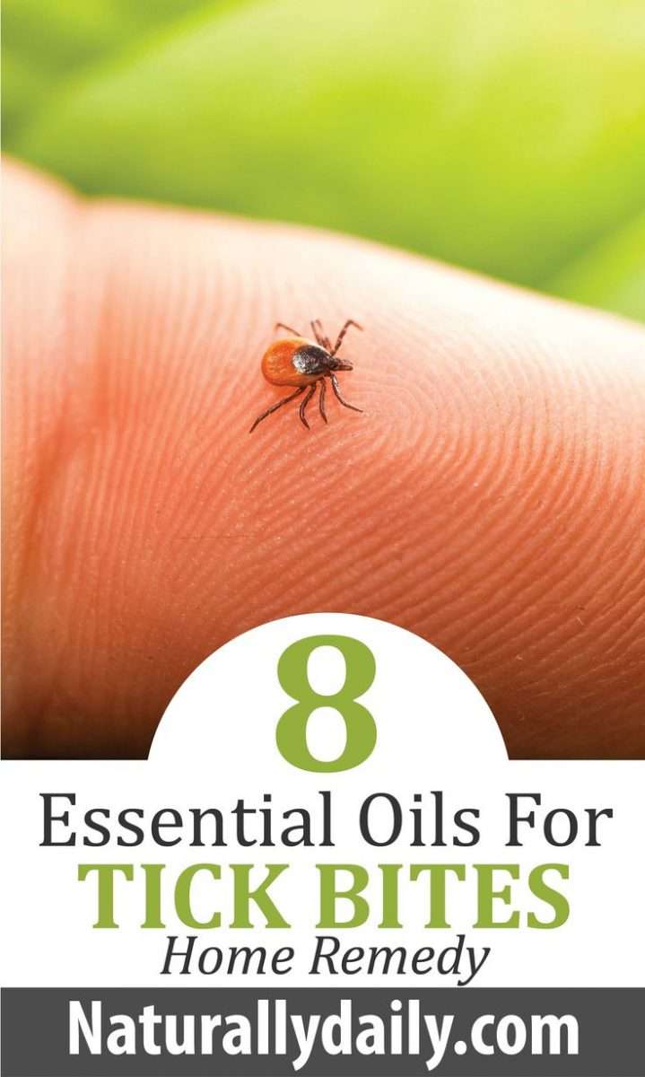 8 Best Essential Oils for Tick Bites Home Remedy (With images)