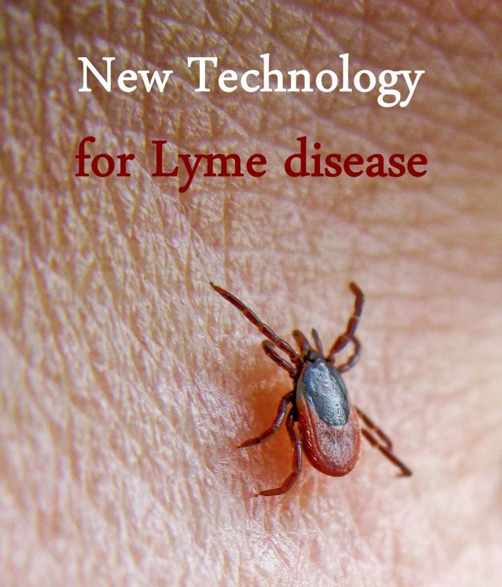 Alternative Medicine: Lyme Disease Treatment Alternative Medicine