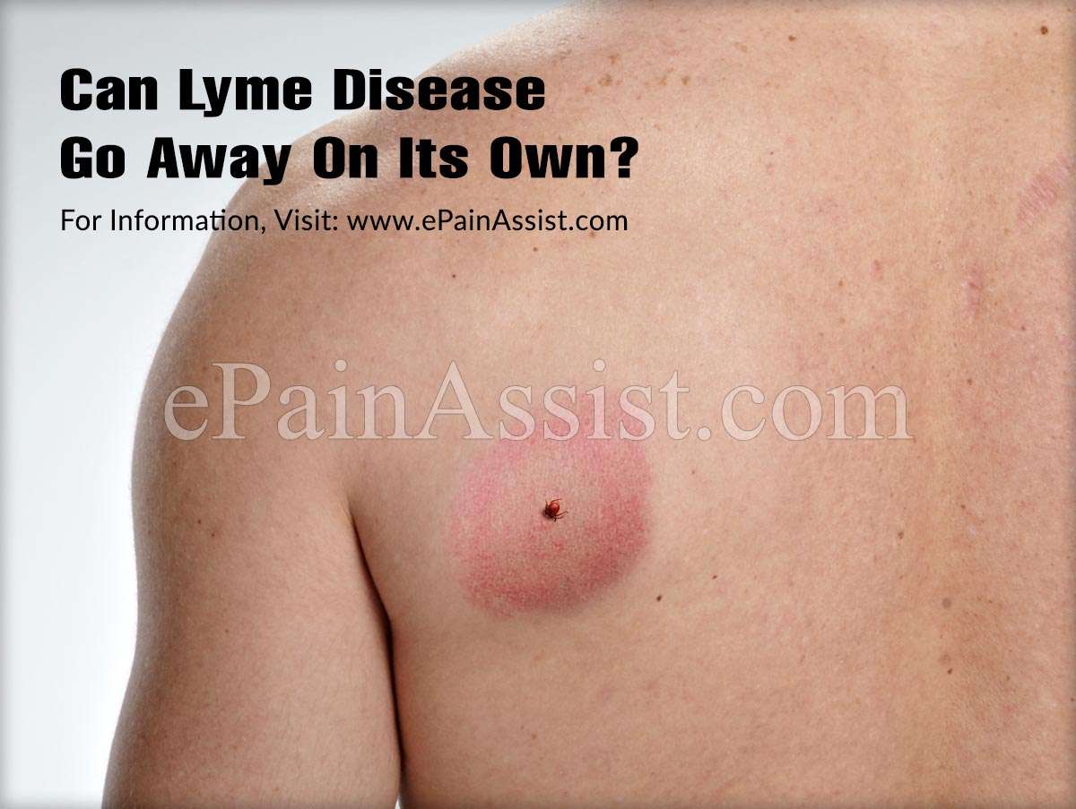 Can Lyme Disease Go Away On Its Own?