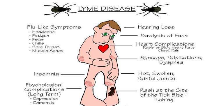 Do you know what is lyme disease?
