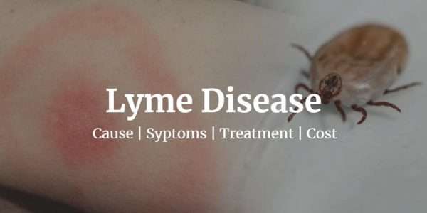 Get Lowest Lyme Disease Test Cost at $91