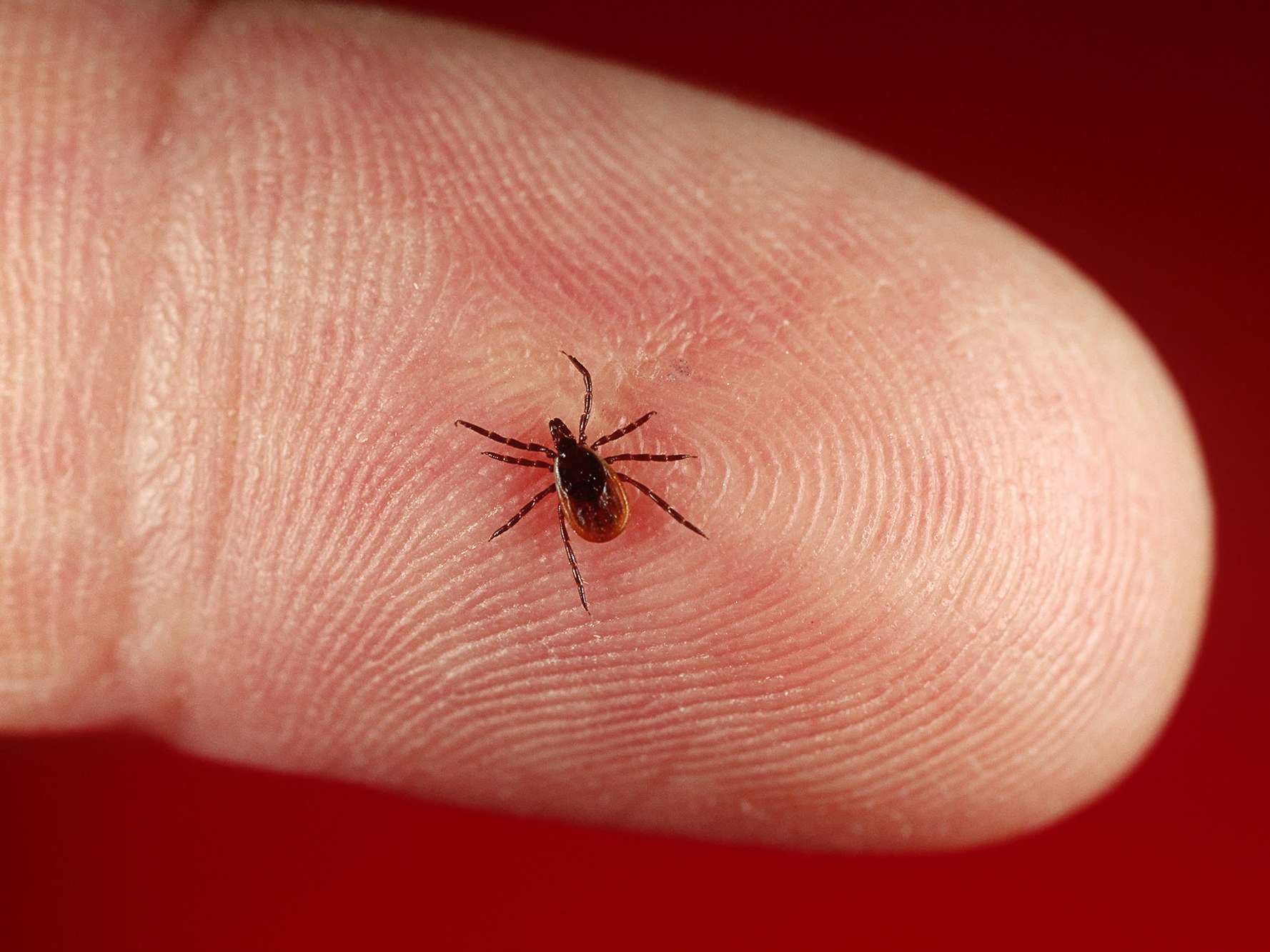 Lyme Disease Is On The Rise Again. Here